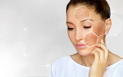 pigmentation treatment